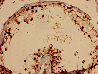 TBC1D31 Antibody
