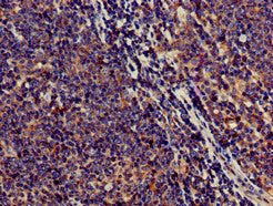 SAMD8 Antibody