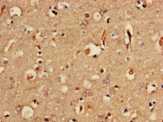 SORCS2 Antibody