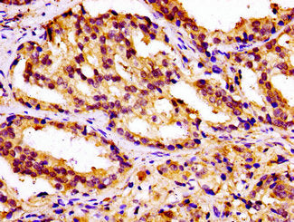 CAMKK2 Antibody