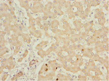 IWS1 Antibody