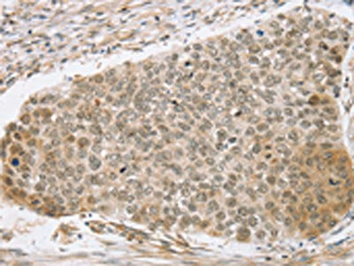 SMARCA2 Antibody