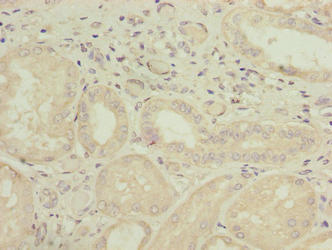 GALNT15 Antibody