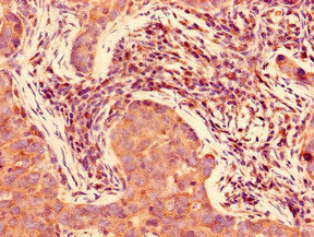 FAM160A2 Antibody