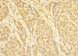 TERB1 Antibody