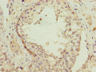 NSUN7 Antibody