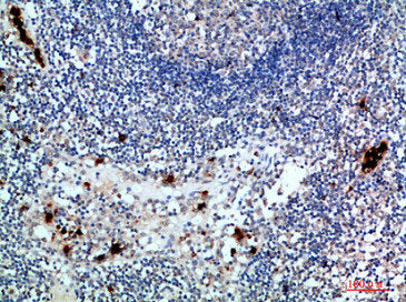 ZAP70 Antibody