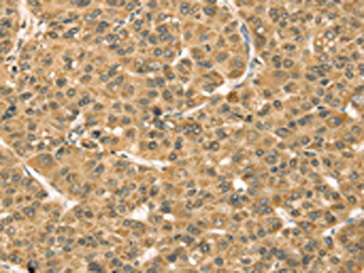 TMPRSS3 Antibody