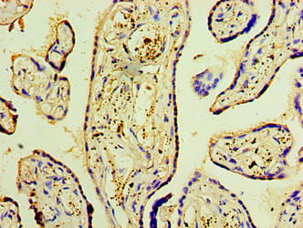 DNAH3 Antibody