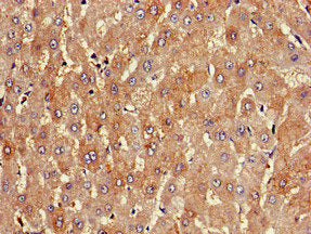 PKD1L1 Antibody