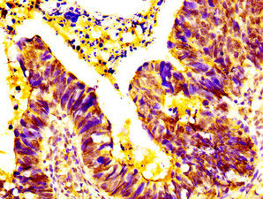 EPS8L3 Antibody