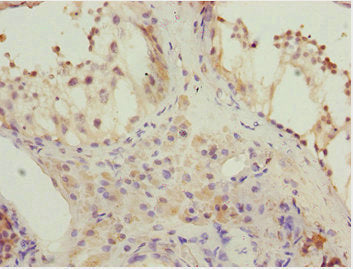 KBTBD7 Antibody