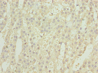 GEMIN6 Antibody