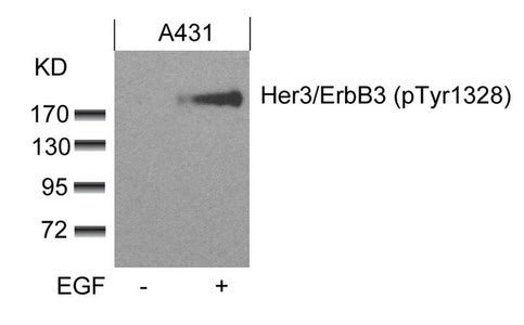Phospho-ERBB3 (Tyr1328) Antibody