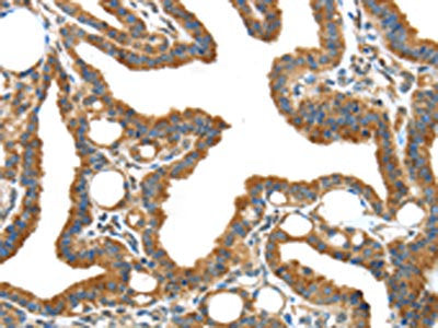 IGFBP3 Antibody