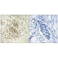 POLE Antibody