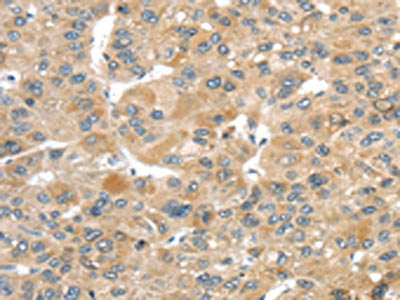 TMEM161A Antibody