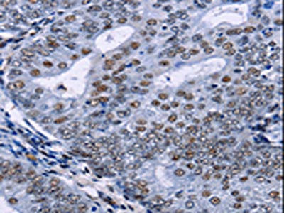 CREBBP Antibody