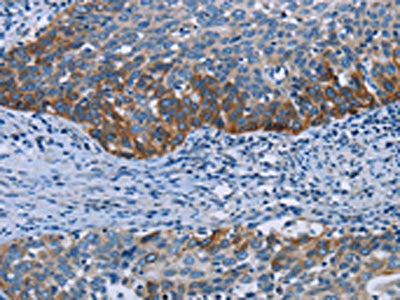 HOMER1 Antibody