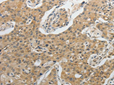 IL1B Antibody
