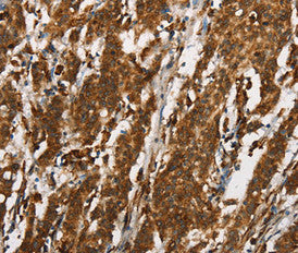 CTAG1A Antibody