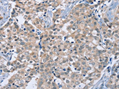 RAB8B Antibody