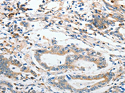 SLC15A2 Antibody