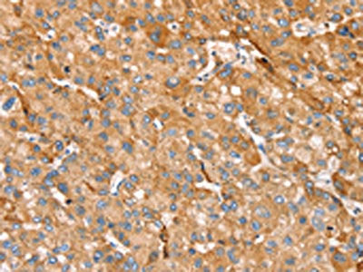 TRIM45 Antibody