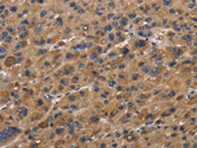 FABP2 Antibody