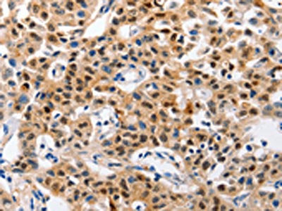 GCG Antibody