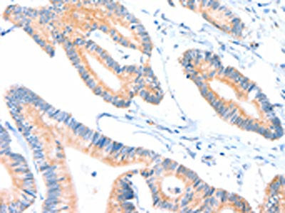ACOX2 Antibody