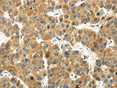 WFDC1 Antibody