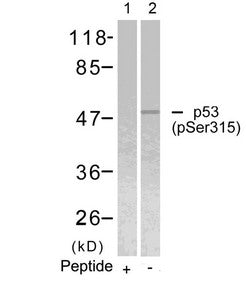 Phospho-TP53 (Ser315) Antibody