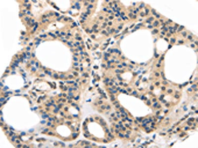 MED28 Antibody