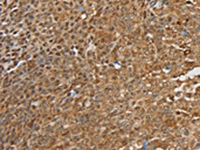 SIGLEC14 Antibody