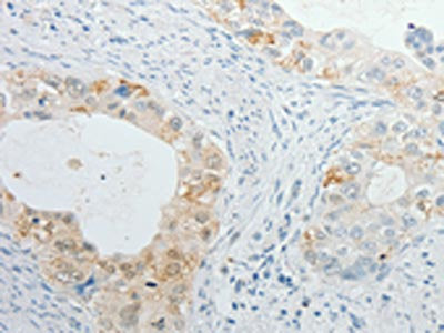 TIMP1 Antibody