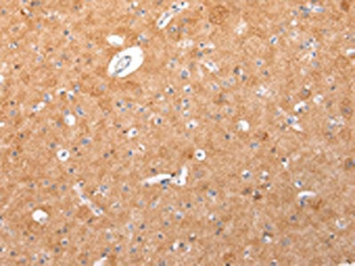 IGLV1-51 Antibody