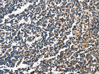 CAGE1 Antibody