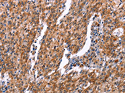 RPS6KA6 Antibody