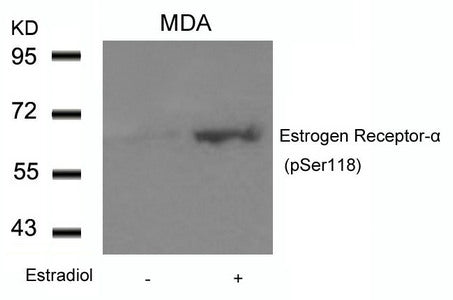 Phospho-ESR1 (Ser118) Antibody