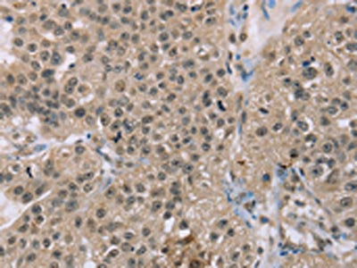 ACTN2 Antibody