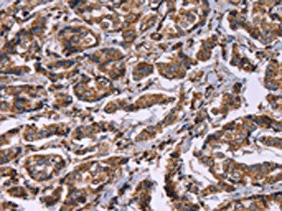 HSPE1 Antibody