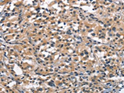 ACPT Antibody