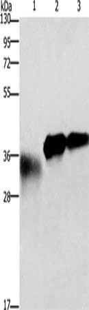 IL1B Antibody