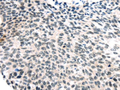 USP7 Antibody