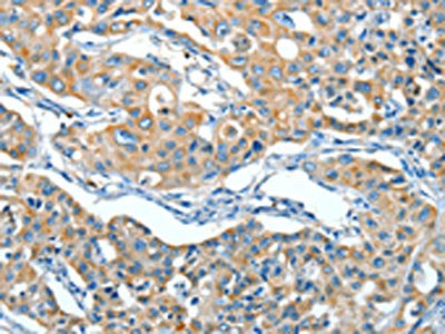 SERPINA3 Antibody