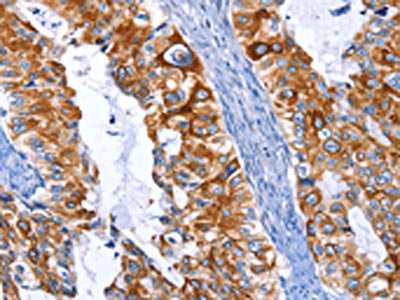 ARRB1 Antibody
