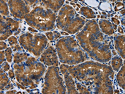 SNCG Antibody