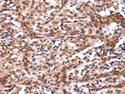 ARRB1 Antibody