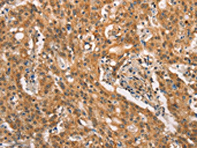 CRKL Antibody